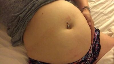 Swollen Belly Girl Bloated Belly Gurgles